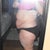 Before tummy tuck and lipo