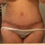 3 weeks PO