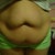 Night before surgery, yuck yuck yuck