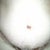 belly button