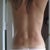 9 months post-op and 10 weeks pregnant