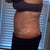 Po day 6 swollen but I like the flatness!