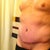POST OP ALMOST 3 MONTHS.