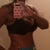 10 days post op
