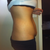 side view 2 weeks pre op