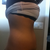 another side view 2 weeks pre op