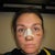 at the office moments before cast removal