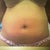 1yr ago B/F Lipo