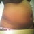 1yr ago B/F Lipo side
