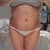 After Lipo