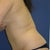 Side view bending