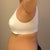1 day post op side view with surgical bra.

3/9/2012