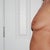 Left Side View - Before on 03/06/2011