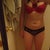 7 weeks post op... right before my menstrual cycle! A little bloated and still some swelling.
