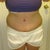 7 weeks po (front)