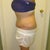 7 weeks po (side)