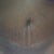 Incision without tape line very thin