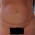 Front view - four months