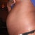 BEFORE SIDE VIEW