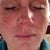 Right after - you can see the freckles darkening immediately.  Taken Feb 16th 2012