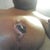 3 weeks post op