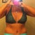 a little swelling over my hips,  wks po