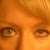 Botox droopy lid...1 week after injection