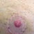 Left boob: second of 2 small scabs left)