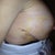 Left breast, feeling virtually no pain:)