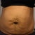 So the ps told me that I have a pretty good size herniated belly button as well....