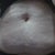 10/30/11 Day before 2nd consult  Down from 210 pounds to 160.