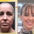 Me before and 6 weeks post on Good Morning Texas