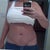 front view almost 4 wks post op