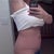 side view almost 4 wks post op