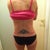 11 days PO.  The doc i saw after seen a dozen was the only one that said I did NOT need lipo!  no more love handles!!  woohoo..  The red marks are from the binder pinching my skin