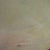 Tiny incision