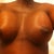 Post op day 2/3. 36B to 36D? 500cc HP