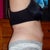 12 WKS POST OP--JUST SO STICKING OUT...UGHHHH