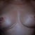 Day 17 after P.O. visit, got all steri-strips removed and 1st time I am seeing my incisions.  Hubby may have been more freaked out than me, since I am lucky enough to see pictures on this site and was knowing what to expect!  Breasts are evening out and I am happy with my small size.  When whole adult life was D and DD, a small C is plenty!