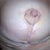 close-up of one breast to show incisions a bit better.  Nipple looks funky in close=up, but there is still glue, etc. and I know they will get more natural looking!