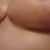2 mths PO - Righty 2