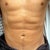 30 days post surgery. Feeling much better now, have started exercising again and am in little to no pain. The area is still a little tender to touch and sore when I stretch but otherwise I'm feeling back to normal.