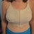 2 days post-op with bra
