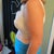 2 days post-op with bra (side view)