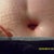 New belly button