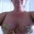 3 days post op