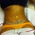 Still have a few stretch marks which i knew i would but the other marks are from the binder.  He changed the gauze from my bb that felt strange but it looks nice and cute.