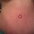 8 weeks up close of belly button..still red scar so no bikini yet!