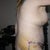 post-op day 7......8th June
Side view before shower.