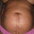 Close up of round belly & c-section scar